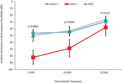 Early Enzyme Replacement Therapy Improves Hearing and Immune Defects in Adenosine Deaminase Deficient-Mice